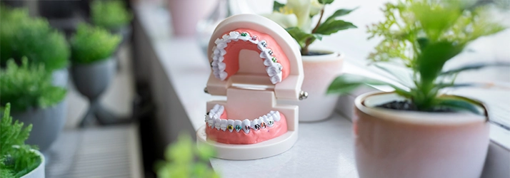 Close-up of a mouth with teeth wearing colorful orthodontic braces.